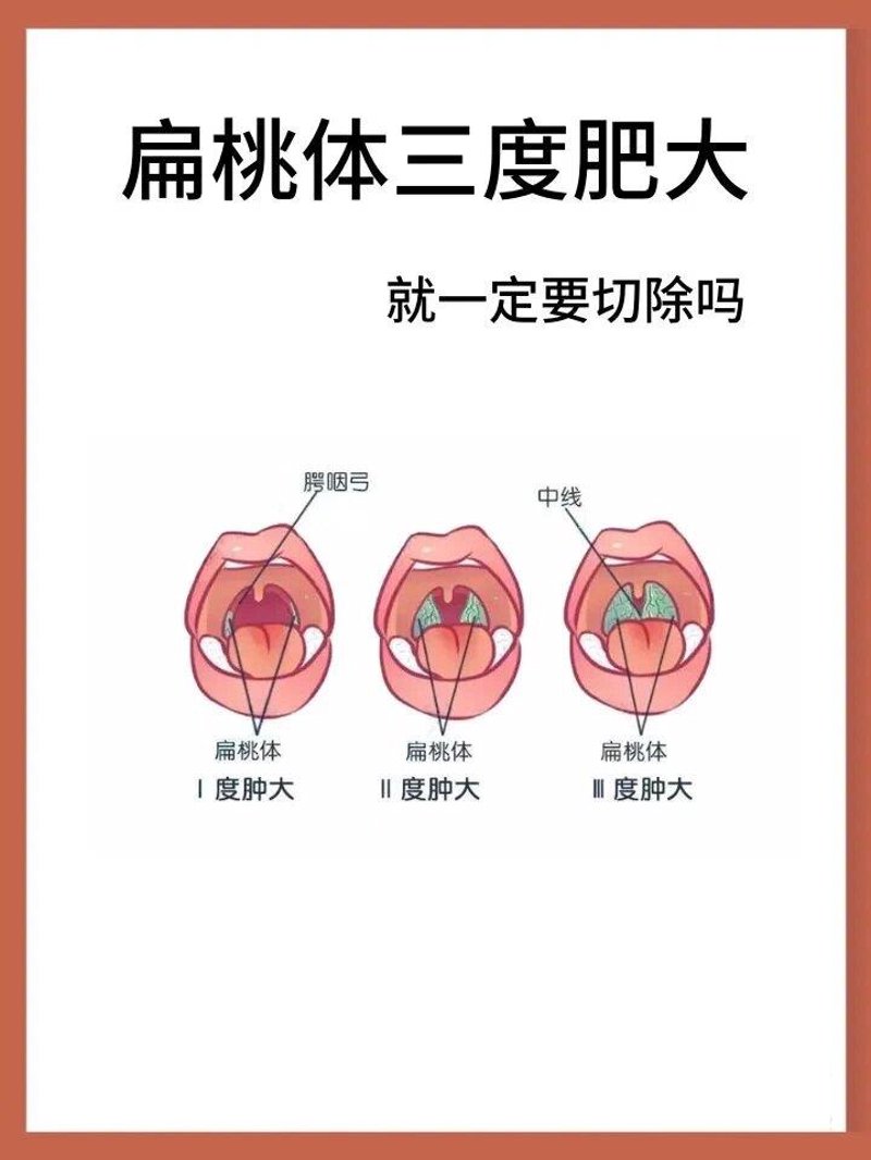 凉山耳鼻喉医院在哪里?—深入解析